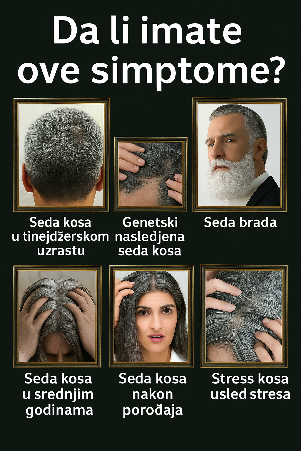 Grafički prikaz tipova sede kose: genetska, stresna, postporođajna
