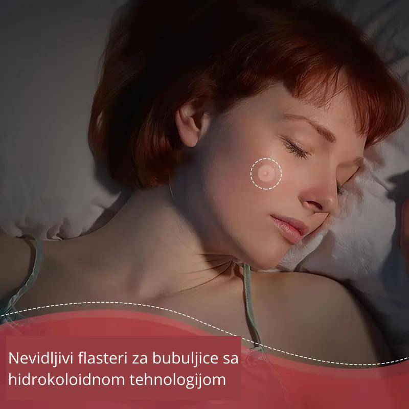 zena sa nevidljivim flasterom za bubuljice dok spava – nocna nega