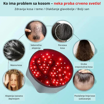 Infografik – problemi sa kosom koje rešava crveno svetlo


