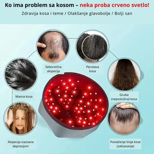 Infografik – problemi sa kosom koje rešava crveno svetlo


