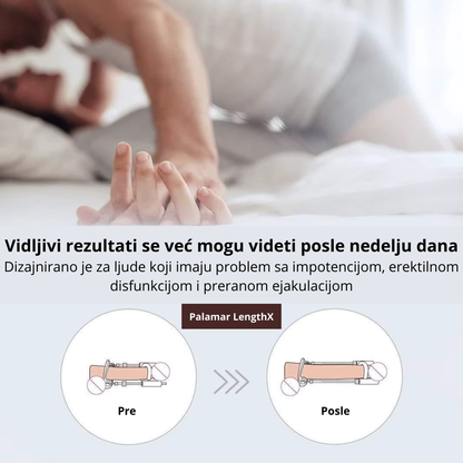 palamar-lengthx-promotivna-slika-sa-upozorenjem